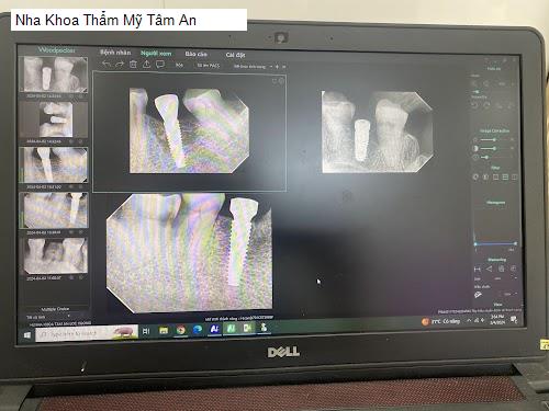 Hình ảnh Nha Khoa Thẩm Mỹ Tâm An
