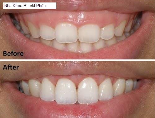 Hình ảnh Nha Khoa Bs ckI Phúc